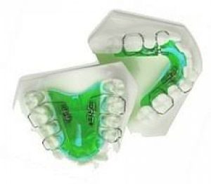 Removable orthodontics