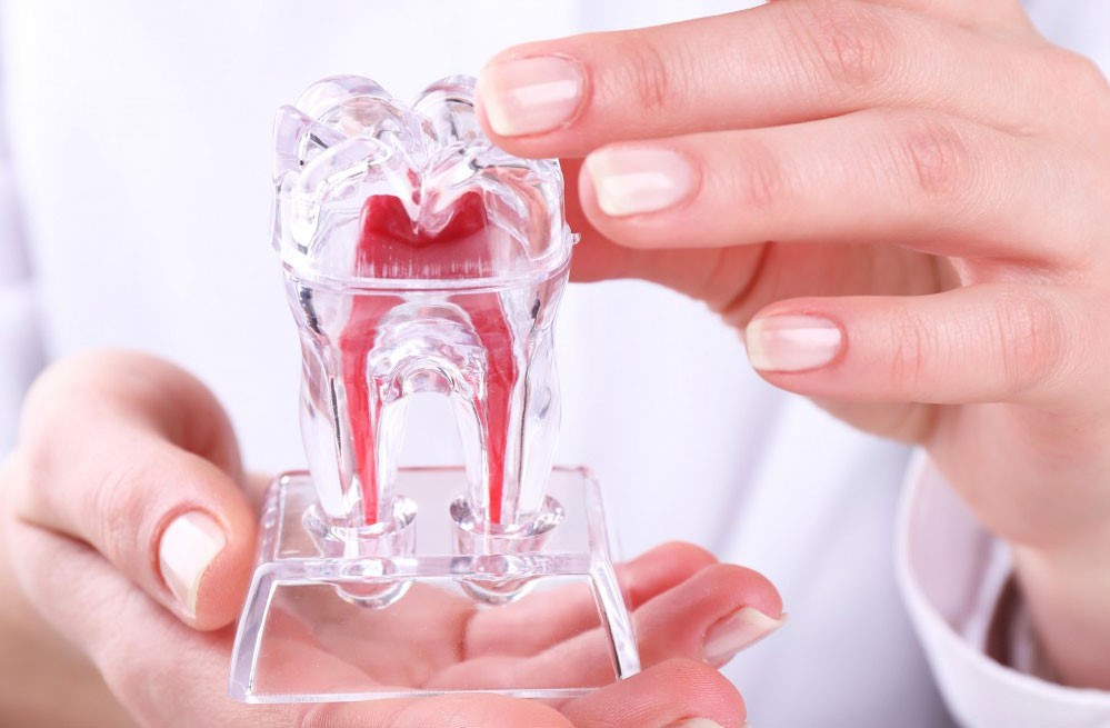 درمان مجدد ریشه دندان RRCT