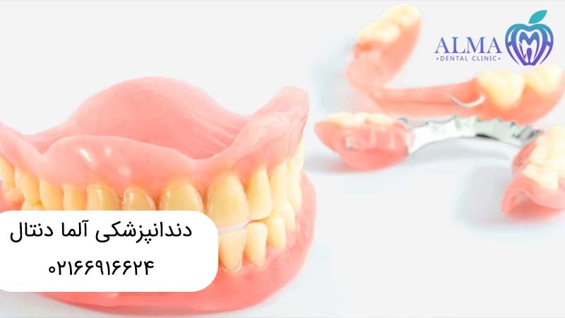 پروتز ثابت دندان