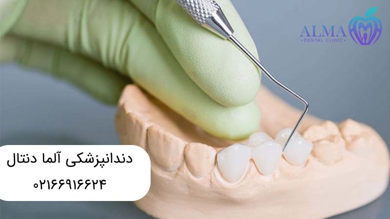ترمیم دندان