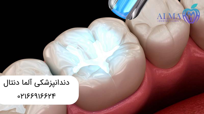 ترمیم دندان