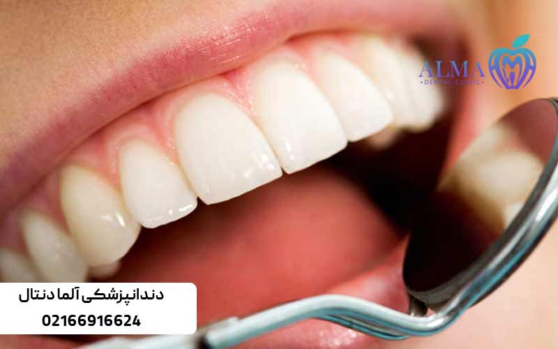 جرمگیری-دندان