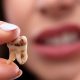 عوارض پوسیدگی دندان