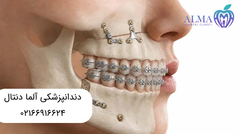 ارتوسرجری چیست
