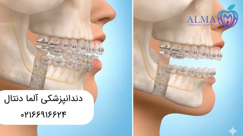 ارتوسرجری چیست