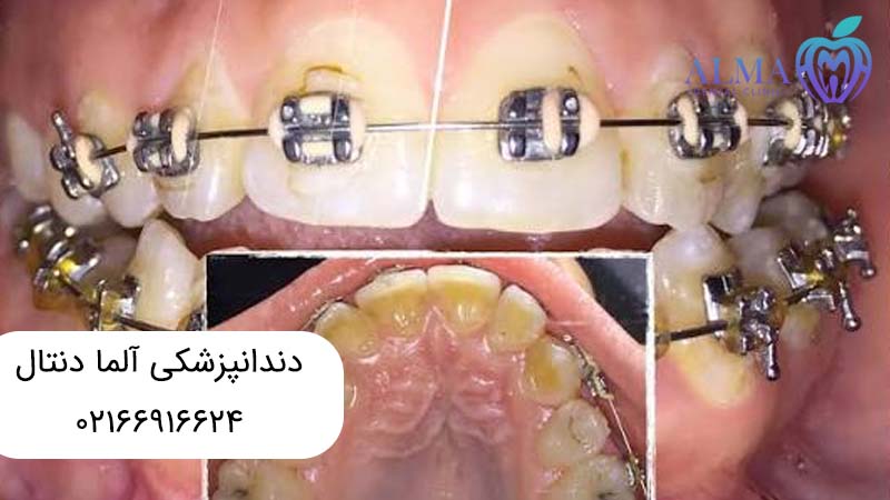 ارتوسرجری چیست
