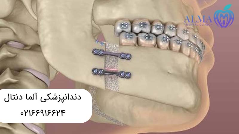 ارتوسرجری چیست