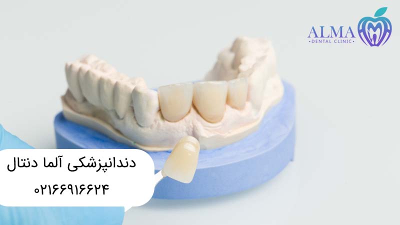 ترمیم تاج دندان