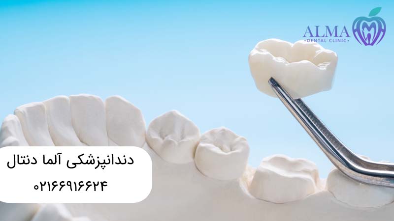 ترمیم تاج دندان