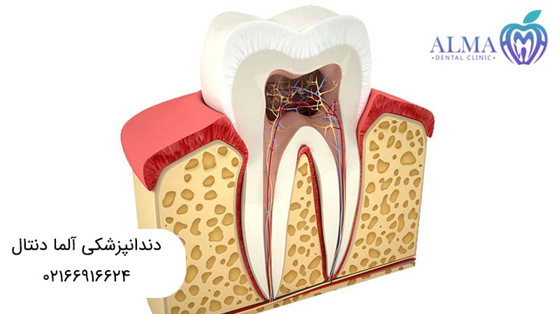 عصب کشی یا کشیدن دندان