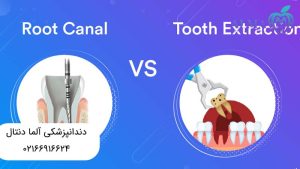 عصب کشی یا کشیدن دندان