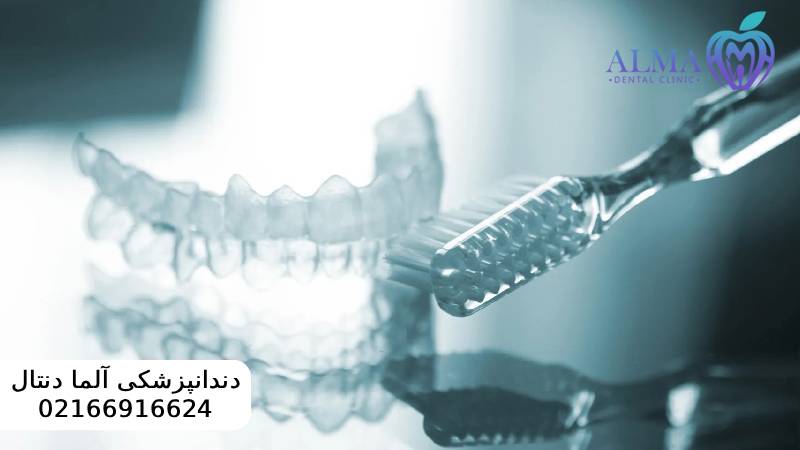 مزایا و معایب ارتودنسی متحرک