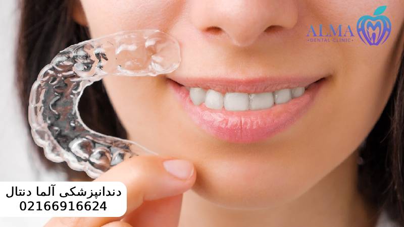 مزایا و معایب ارتودنسی متحرک