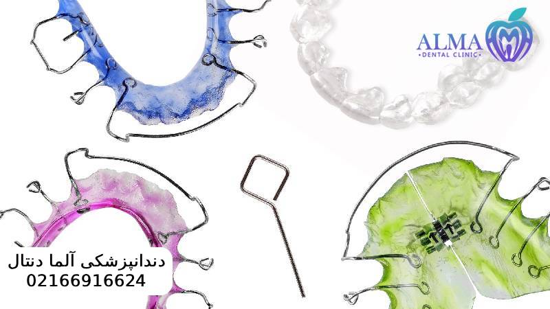 مزایا و معایب ارتودنسی متحرک