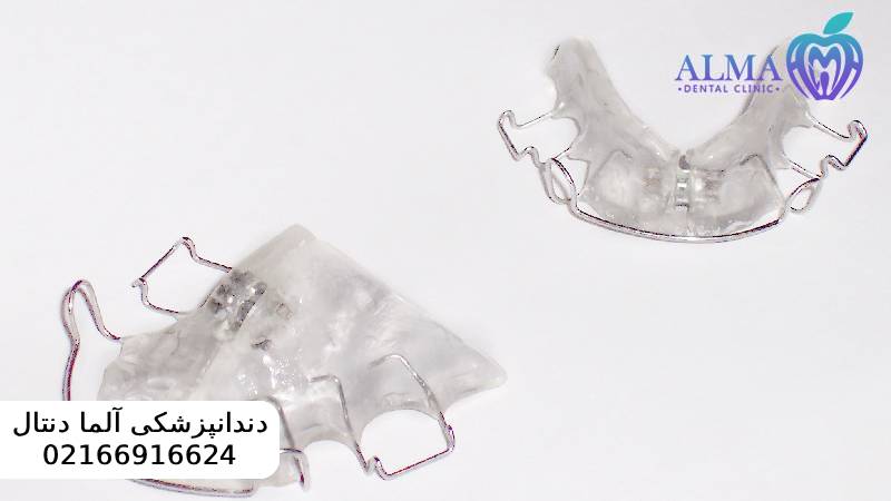 مزایا و معایب ارتودنسی متحرک