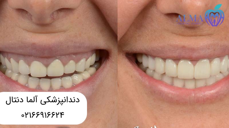 درمانهای زیبایی دندان