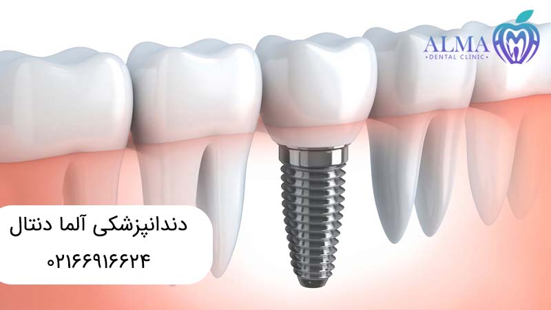 درمانهای زیبایی دندان
