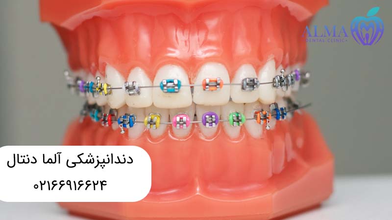 درمانهای زیبایی دندان