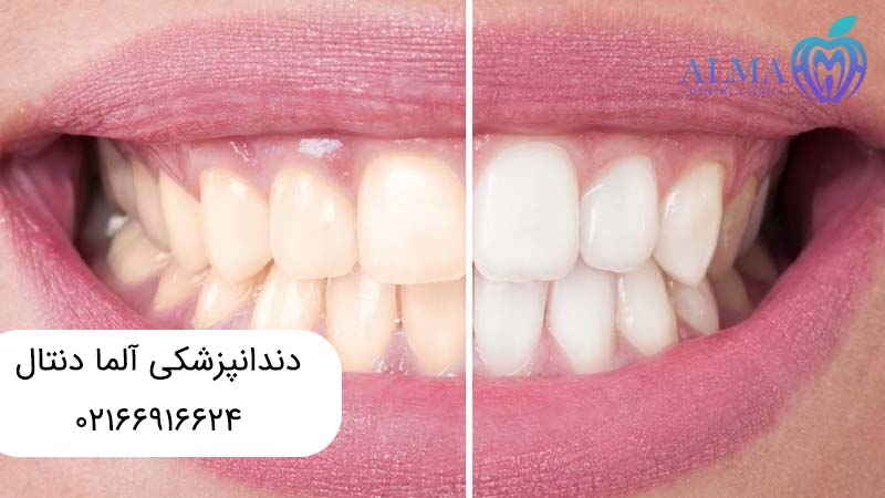 درمانهای زیبایی دندان