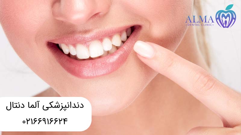 درمانهای زیبایی دندان