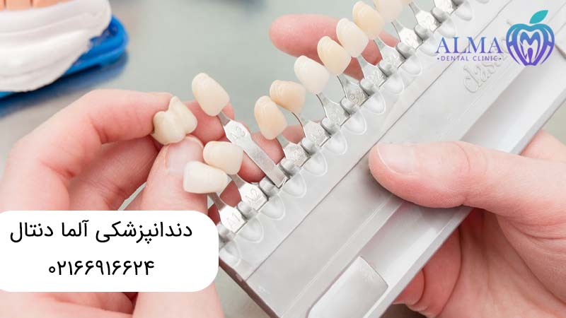 درمانهای زیبایی دندان