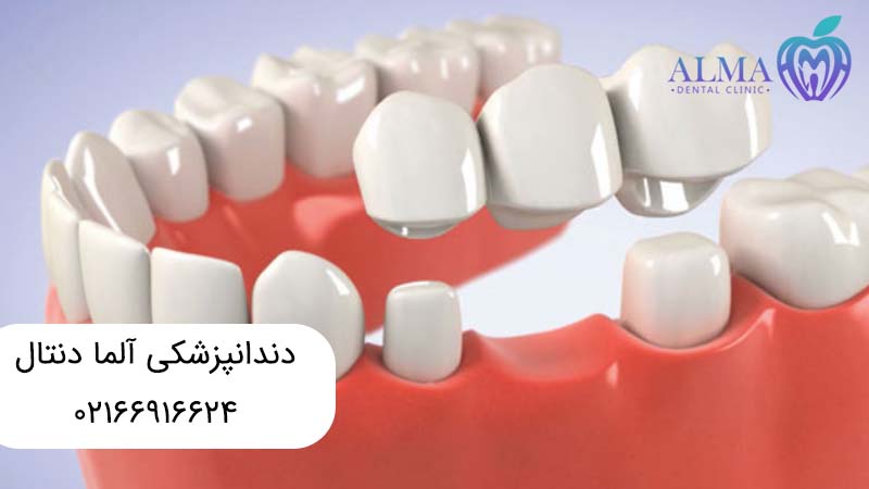 درمانهای زیبایی دندان