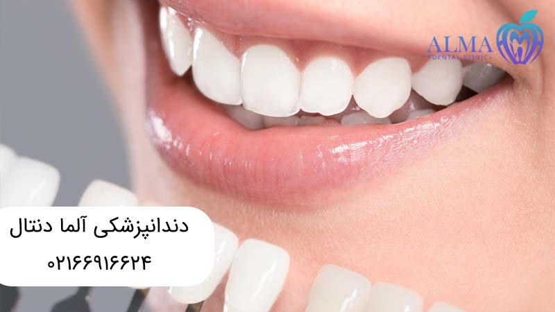 درمانهای زیبایی دندان