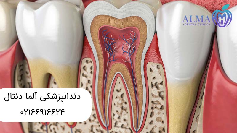 فرق درمان ریشه با عصب کشی