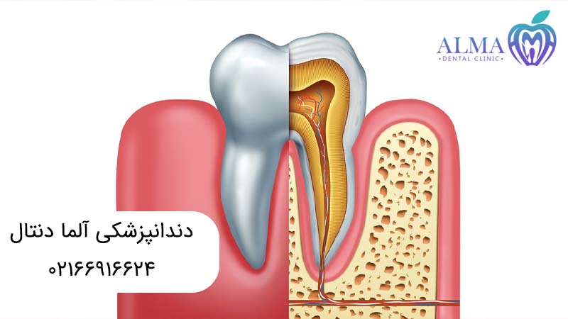 فرق درمان ریشه با عصب کشی