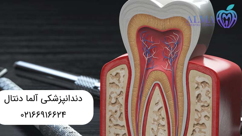 فرق درمان ریشه با عصب کشی